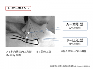 胸郭出口症候群 越谷市大沢 東大沢整形外科内科リハビリテーションクリニック 公式